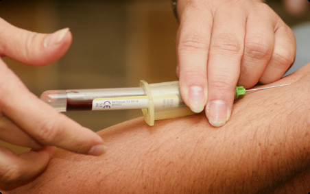 尿液突然变色，身体在发出这些“警报”！   每天排出的尿液，就像是身体悄悄递出的“健康报告”，它的颜色变化藏着许多秘密...